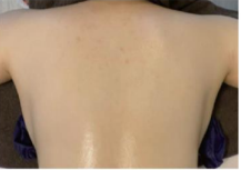 ボディーピーリング