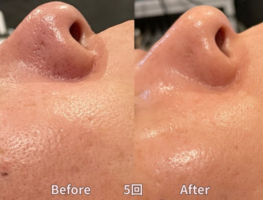 フェイシャルトリートメント