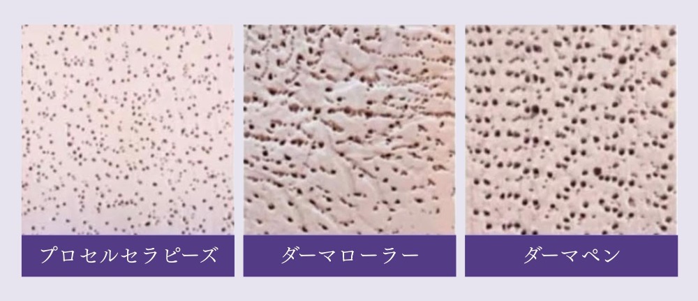 高度な専門性と結果重視のトリートメントシステム